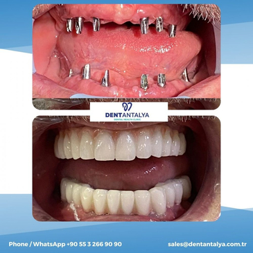 Slider image (7) Dent Antalya